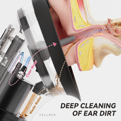 Cutaway showing water flushing earwax from the ear canal into the EarFlow E80 waste chamber