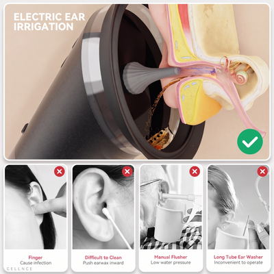 Electric ear irrigation compared with fingers, cotton swabs, a manual flusher and a long tube ear washer